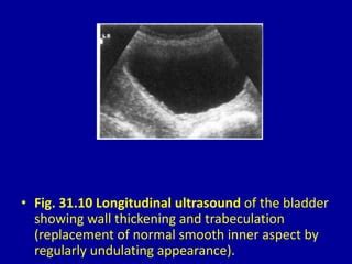 31 DAVID SUTTON PICTURES THE BLADDER AND PROSTATE | PPT