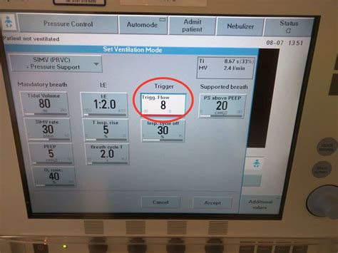 Setting up the Ventilator | Paediatric Emergencies