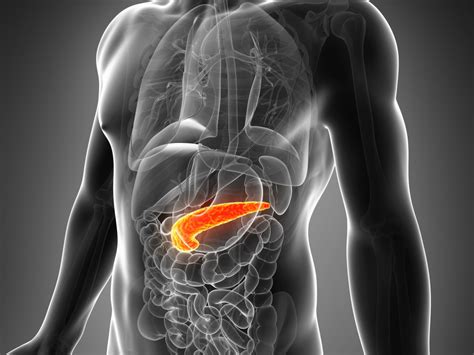 Acute pancreatitis may reveal pancreatic cancer at earlier stage - The ...