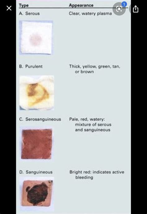 Wound Drainage Color Chart