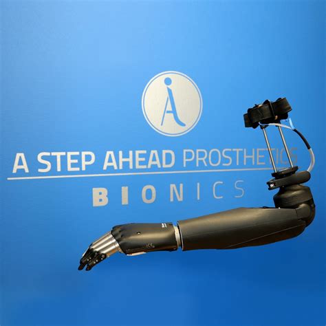 osseointegration-arm-upper-3 - A Step Ahead Prosthetics