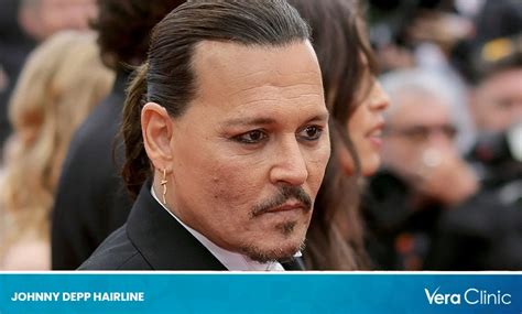 Johnny Depp Hairline: The Fact Behind the Speculations