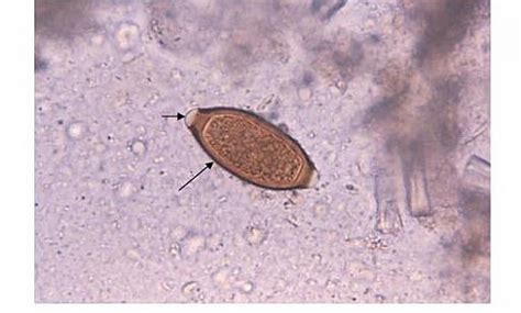 Trichuris Trichiura (Whipworm) Symptoms, Morphology, Egg, Life Cycle and Treatment - Jotscroll