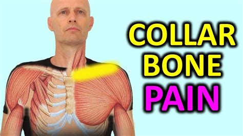 Sore Collar Bone? Fix Collarbone Pain & AC Joint Pain Quickly. - YouTube