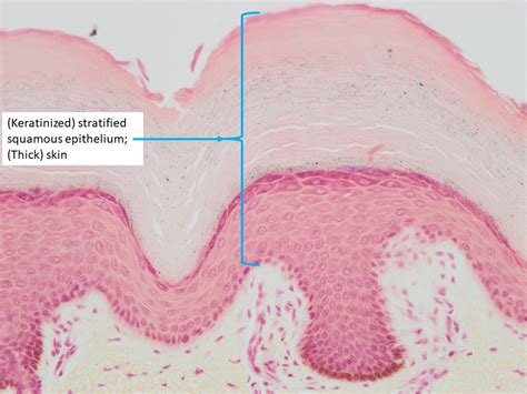 Stratified Squamous Epithelium Non Keratinized Esophagus