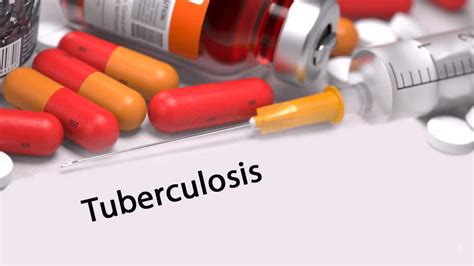 Tratamiento de la tuberculosis - Mejor con Salud