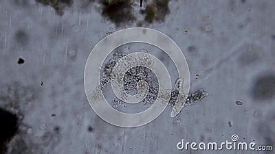 Amoebae Microbiology Under the Microscope. Stock Footage - Video of food, aquatic: 256002512