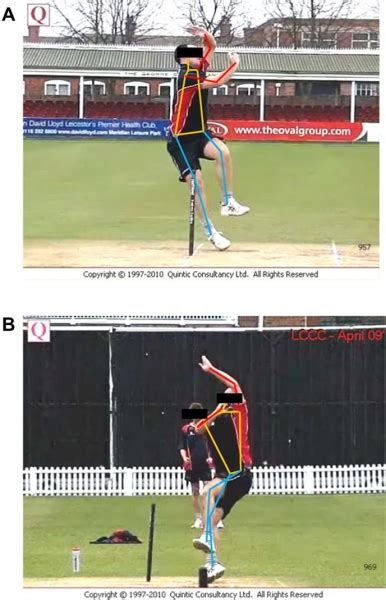 File:Mixed bowling action.jpg - Physiopedia