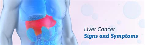 Liver Cancer: Early Signs Of Liver Cancer