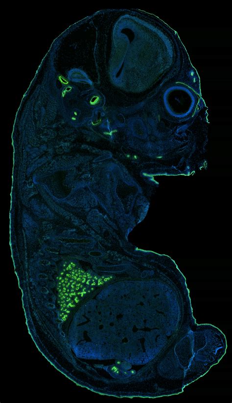 Mouse embryo section (E15.5) labeled with EpCAM antibody - BiCell Blue