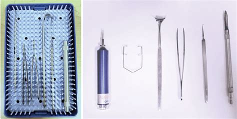 Clinical Pearls in Corneal Foreign Body Removal