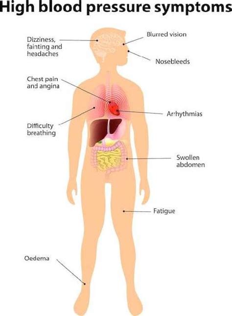 High Blood Pressure (HBP)/ Hypertension: Symptoms, Complications, and Treatment