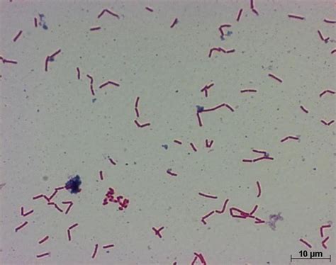 CLOSTRIDIUM BIFERMENTANS PDF