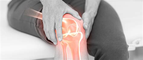 Gonartrosis o artrosis de rodilla ¿cómo aliviar el dolor? | Gonartrosis | Artrosis de rodilla