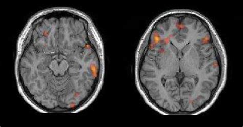 Bilateral Broca's and left Wernicke's area Orientation and background... | Download Scientific ...