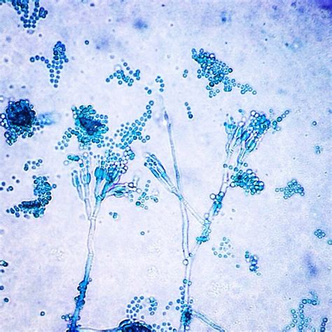 Lactophenol Cotton Blue Stain of Penicillium Species | Medical ...