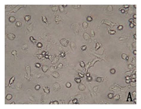 Morphological characteristics of dendritic cells in light microscope ...