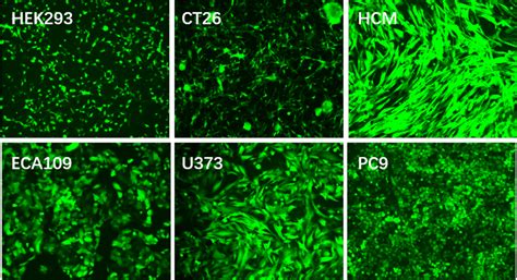 Lentivirus Vector System | GeneMedi