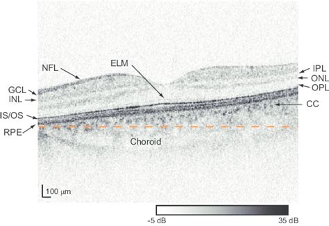 Macula Lutea Histology