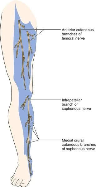 Femoral neuropathy treatment options Archives - Samarpan Physiotherapy Clinic