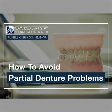 How to Avoid Partial Denture Problems In Mansfield