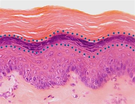 Stratified Squamous Epithelium Keratinized 400x