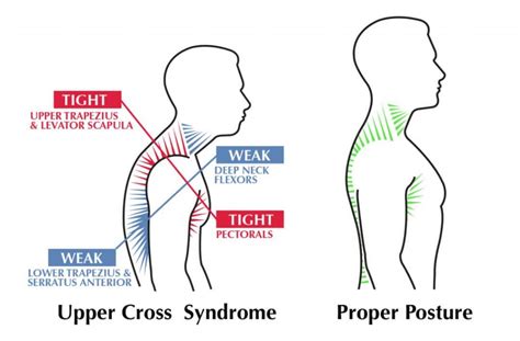 Desk Stretches Part 3 – Upper Back | Back to Balance Osteopathy