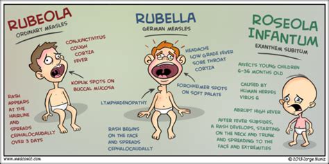 German Measles timeline | Timetoast timelines