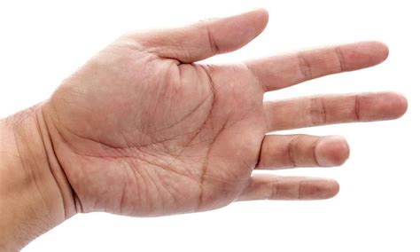 What Causes Trigger Finger?: Brad Carofino, MD: Shoulder and Hand Surgeon