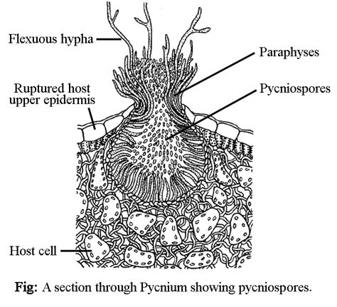 PUCCINIA - CLASSIFICATION, VEGETATIVE STRUCTURE, REPRODUCTION, ECONOMIC IMPORTANCE