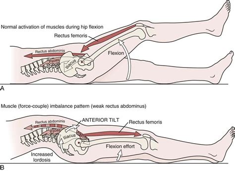 Pin de chanok anuntaprecha en anatomy | Patologia