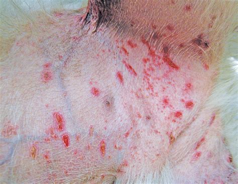 Top 5 Causes of Nonblanching Skin Lesions | Clinician's Brief