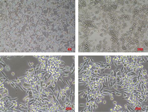 What's your opinion about the confluency of this HepG2 cells?