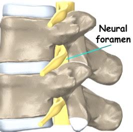 Neural foramen - Burquitlam Physiotherapy