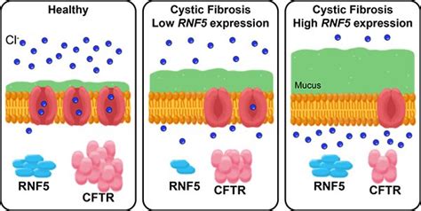 What You Need To Know: Cystic Fibrosis Mutation