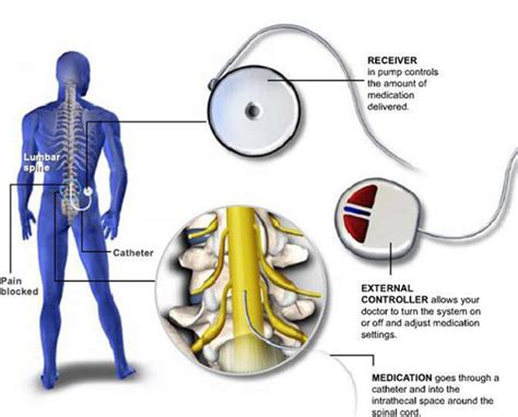 Global Pain Care | Dr. Navdeep Loomba