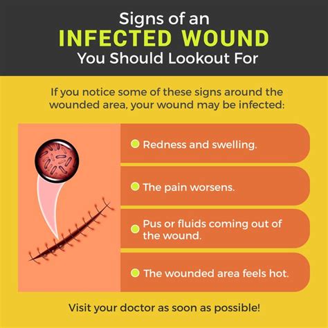 Signs of an Infected Wound You Should Lookout For #Signs #Infection | Home health agency, Diy ...