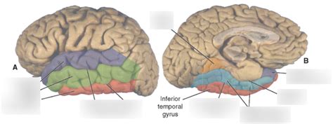 Temporal Lobe Anatomy Diagram | Quizlet