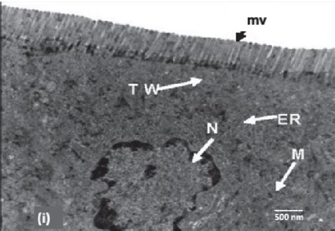 Electromicrograph of intestinal mucosal epithelial cell showing the ...