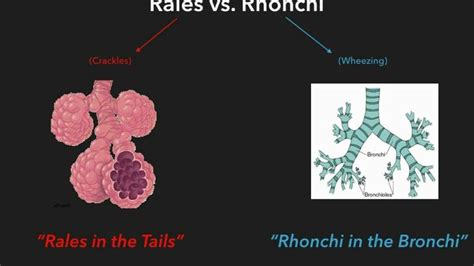 Love this pnemonic for Rales vs Rhonchi | I school, Nurse, Paramedic