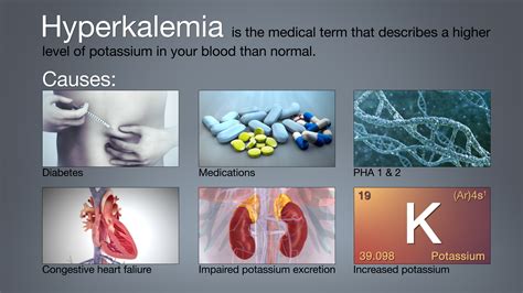 Hyperkalemia: Symptoms, Causes, and Treatment