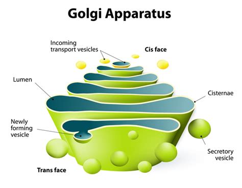 Achondrogenesis: MedlinePlus Genetics