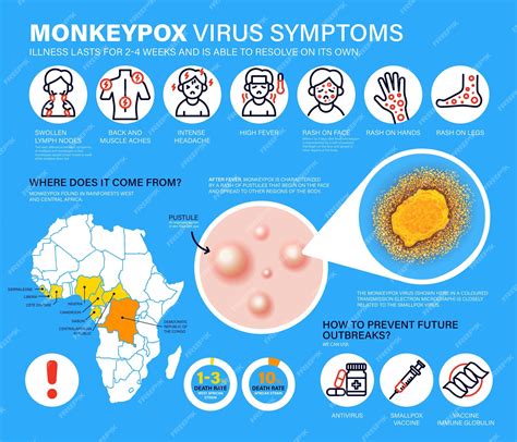 Premium Vector | Monkeypox virus symptoms and monkeypox virus detailed ...