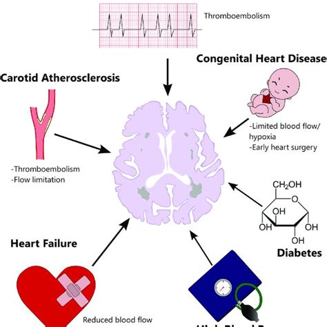 Periventricular and subcortical white matter hyperintensities. MRI,... | Download Scientific Diagram