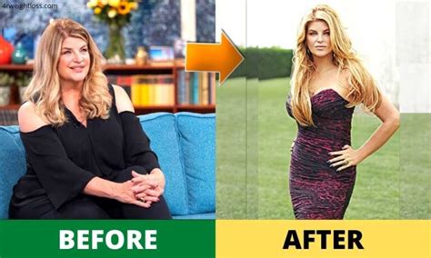 Kirstie Alley Weight Loss 2024: Diet, Surgery, Before & After Photos