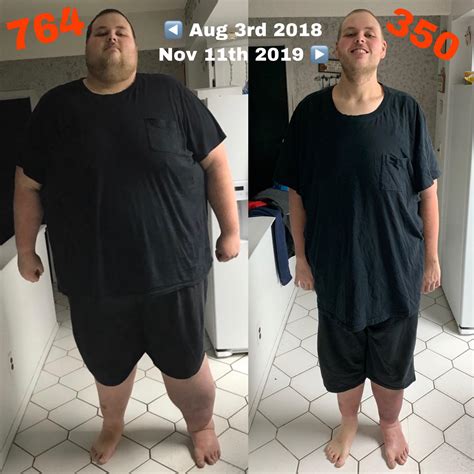 M/31/6’8” [764lbs = 350lbs = 414lbs] Update #5 Goodbye Morbid Obesity ...