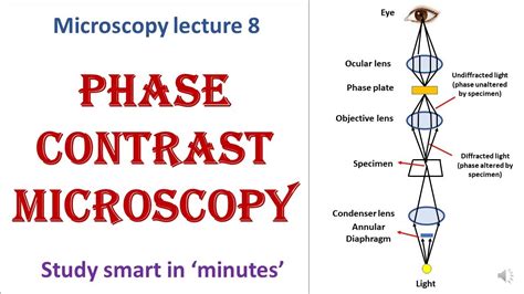 Phase contrast microscope | working principle | Advantages, disadvantages | Microscopy lecture 8 ...