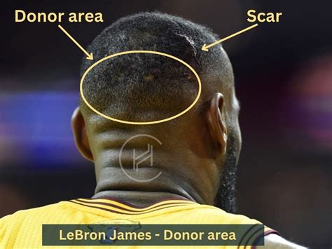 Lebron Hairline Timeline 2022