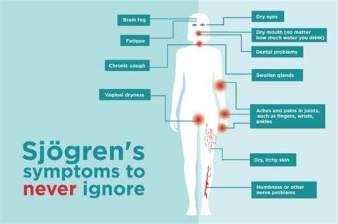 Sjögren’s Syndrome Symptoms You Might Be Ignoring | Sjogrens syndrome, Skin symptoms, Autoimmune ...