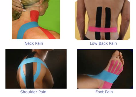 Kinesio Taping: What Is That Colored Tape And How Can It Help You? - Morgan Massage - Massage in ...